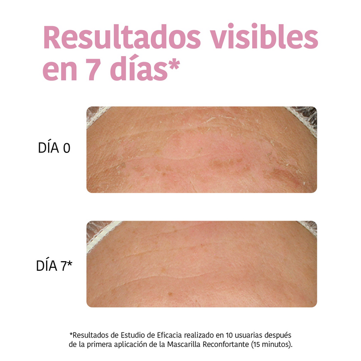 Mascarilla Facial Hidratante con Aloe Vera