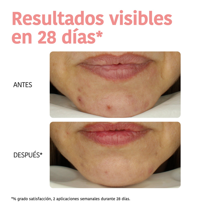 Mascarilla Facial Peeling con Ácido Glicólico