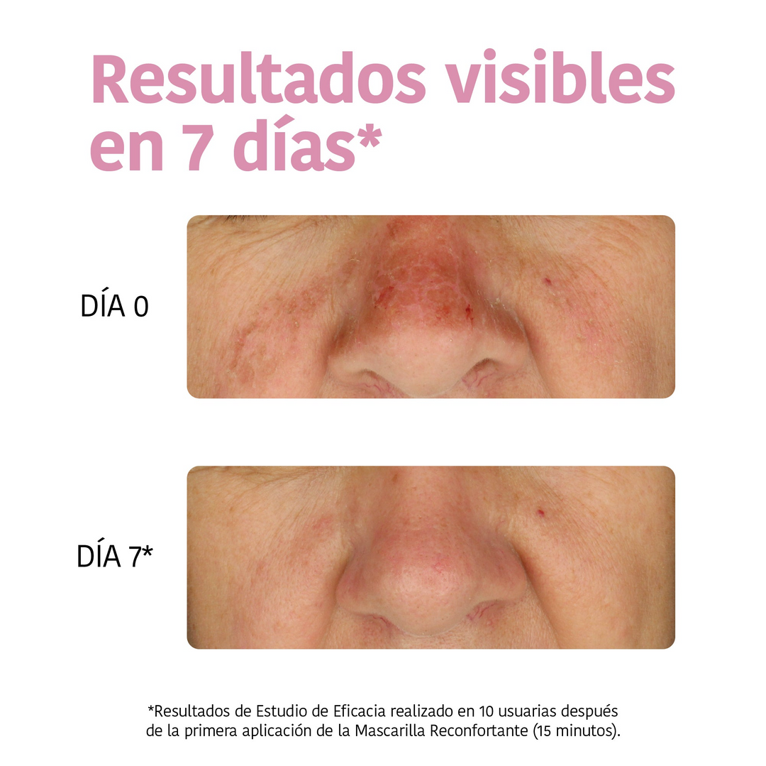 Mascarilla Facial Hidratante con Aloe Vera