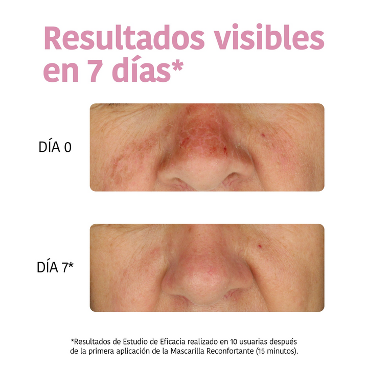 Mascarilla Facial Hidratante con Aloe Vera