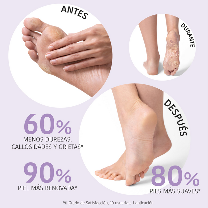 Calcetines Exfoliantes y Peeling con Ácido Glicólico